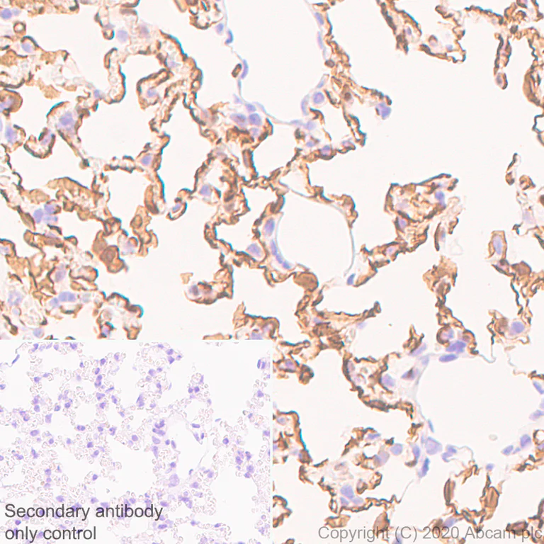 Immunohistochemistry (Formalin/PFA-fixed paraffin-embedded sections) - Anti-PRX antibody [EPR24150-36] - BSA and Azide free (AB278083)