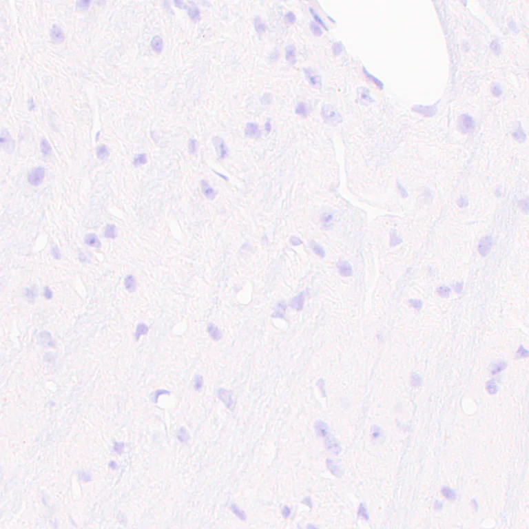Immunohistochemistry (Formalin/PFA-fixed paraffin-embedded sections) - Anti-PRX antibody [EPR24150-36] - BSA and Azide free (AB278083)