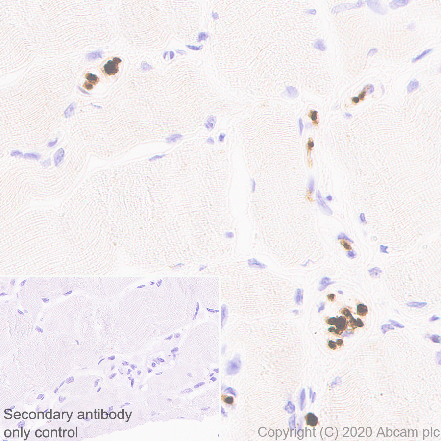 Immunohistochemistry (Formalin/PFA-fixed paraffin-embedded sections) - Anti-PRX antibody [EPR24150-36] - BSA and Azide free (AB278083)