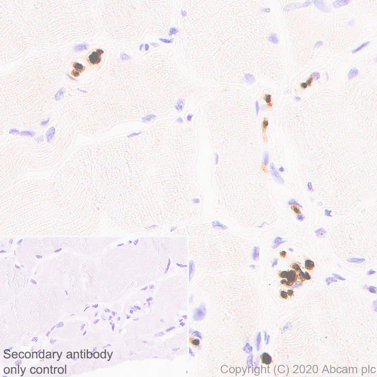 Immunohistochemistry (Formalin/PFA-fixed paraffin-embedded sections) - Anti-PRX antibody [EPR24150-36] - BSA and Azide free (AB278083)