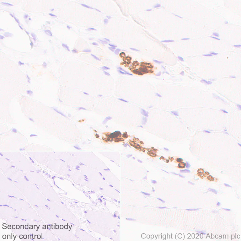 Immunohistochemistry (Formalin/PFA-fixed paraffin-embedded sections) - Anti-PRX antibody [EPR24150-36] - BSA and Azide free (AB278083)