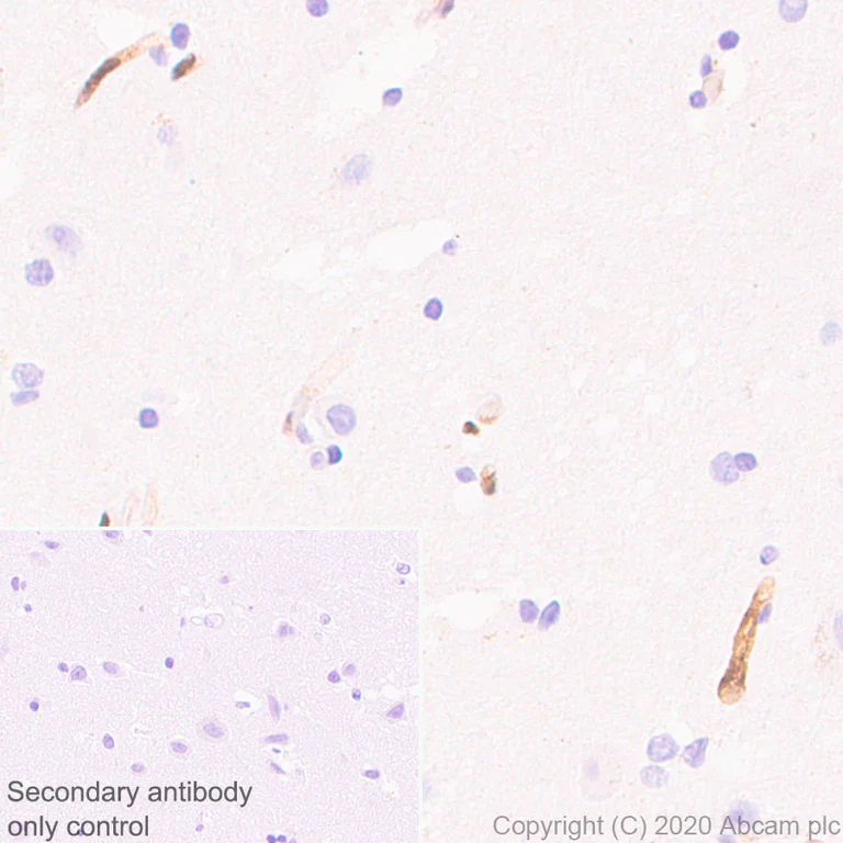 Immunohistochemistry (Formalin/PFA-fixed paraffin-embedded sections) - Anti-PRX antibody [EPR24150-36] - BSA and Azide free (AB278083)