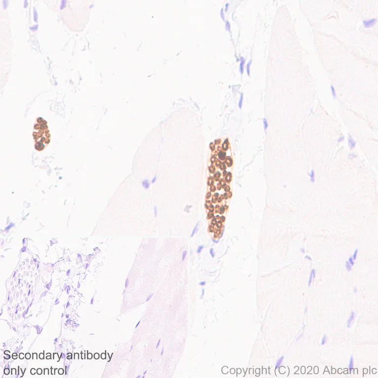 Immunohistochemistry (Formalin/PFA-fixed paraffin-embedded sections) - Anti-PRX antibody [EPR24150-36] - BSA and Azide free (AB278083)