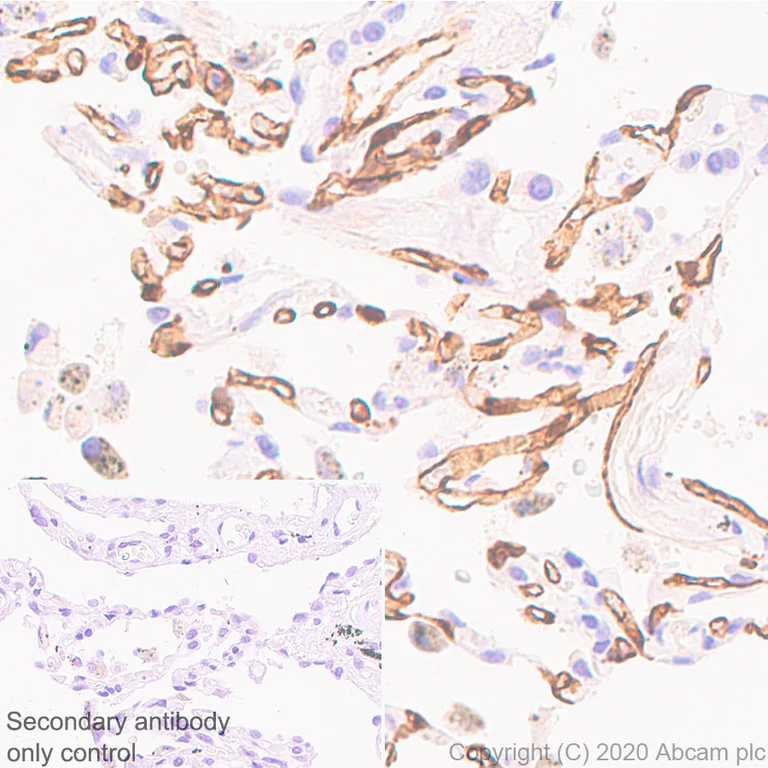 Immunohistochemistry (Formalin/PFA-fixed paraffin-embedded sections) - Anti-PRX antibody [EPR24150-36] - BSA and Azide free (AB278083)