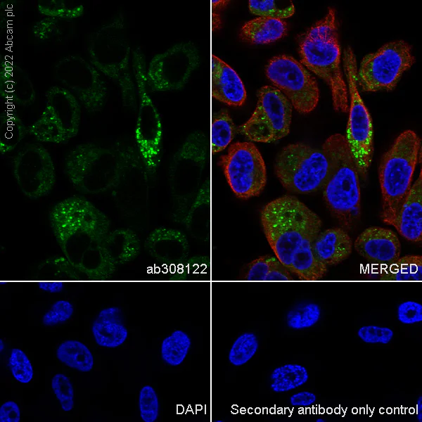 Immunocytochemistry/ Immunofluorescence - Anti-PSAP antibody [EPR25649-20] (AB308122)