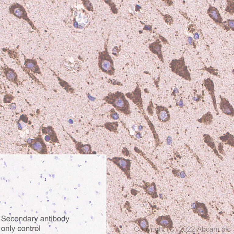 Immunohistochemistry - Anti-PSAP antibody [EPR25649-20] - BSA and Azide free (AB308123)