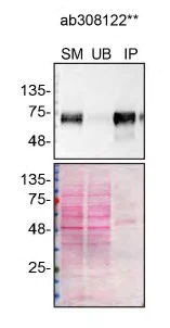 Immunoprecipitation - Anti-PSAP antibody [EPR25649-20] - BSA and Azide free (AB308123)