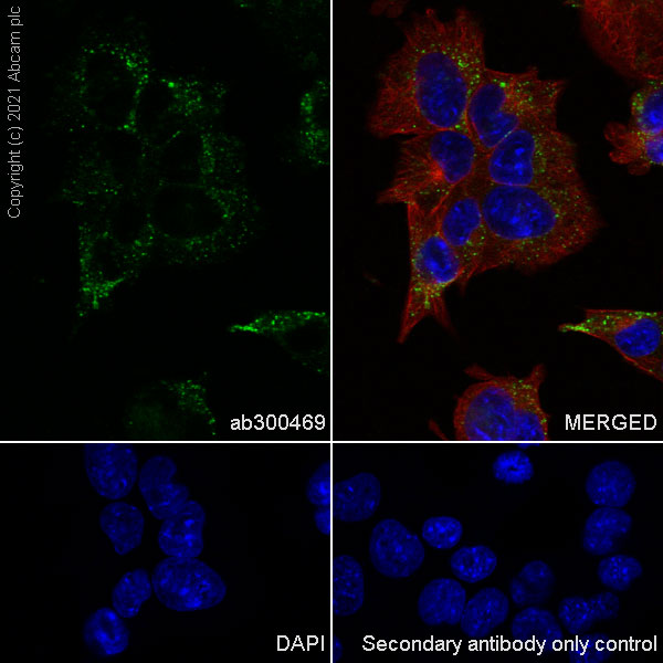 Immunocytochemistry/ Immunofluorescence - Anti-PSAP antibody [EPR25650-11] (AB300469)