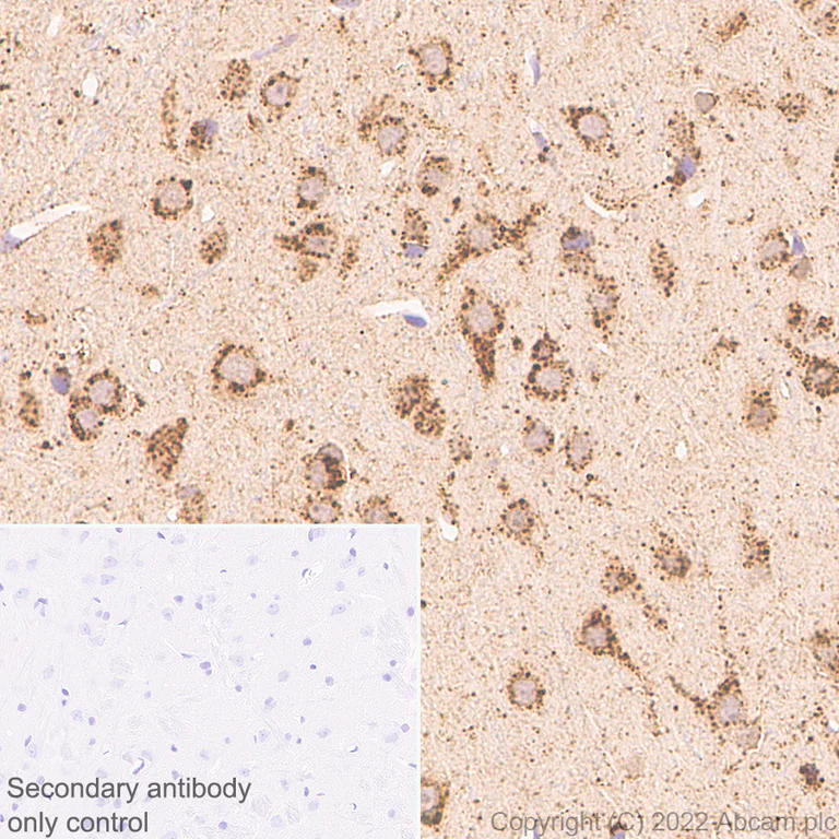 Immunohistochemistry (Formalin/PFA-fixed paraffin-embedded sections) - Anti-PSAP antibody [EPR25650-11] (AB300469)