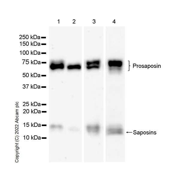 Western blot - Anti-PSAP antibody [EPR25650-11] (AB300469)