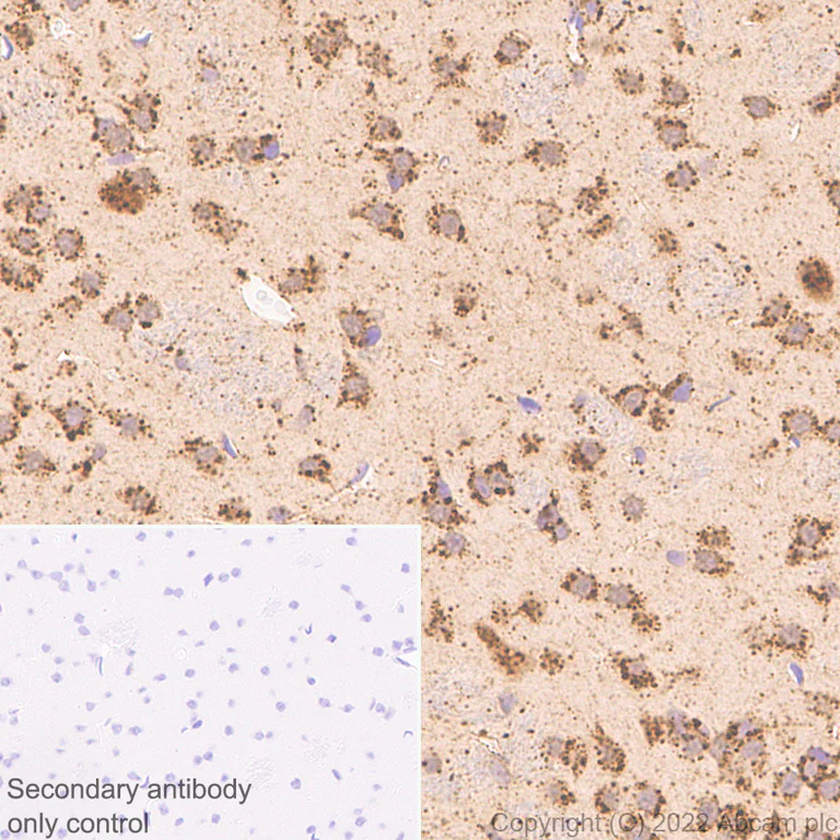 Immunohistochemistry (Formalin/PFA-fixed paraffin-embedded sections) - Anti-PSAP antibody [EPR25650-11] (BSA and Azide free) (AB300470)