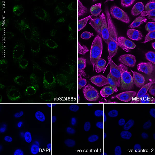 Immunocytochemistry/ Immunofluorescence - Anti-PSAP antibody [RM1353] (AB324885)
