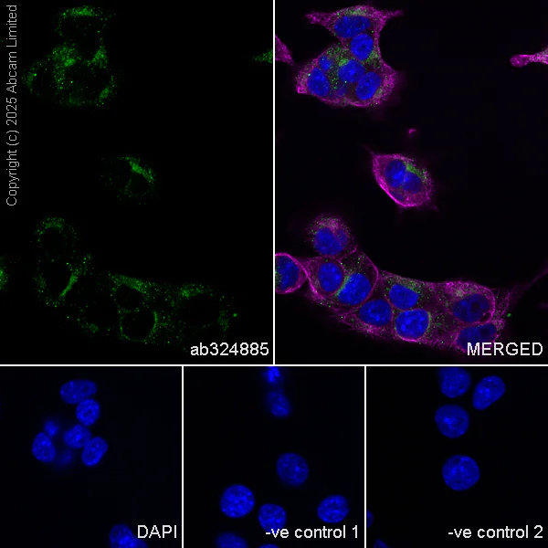 Immunocytochemistry/ Immunofluorescence - Anti-PSAP antibody [RM1353] (AB324885)