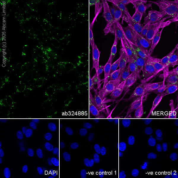 Immunocytochemistry/ Immunofluorescence - Anti-PSAP antibody [RM1353] (AB324885)