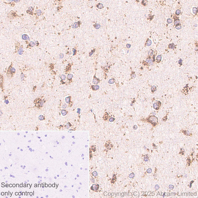 Immunohistochemistry (Formalin/PFA-fixed paraffin-embedded sections) - Anti-PSAP antibody [RM1353] (AB324885)