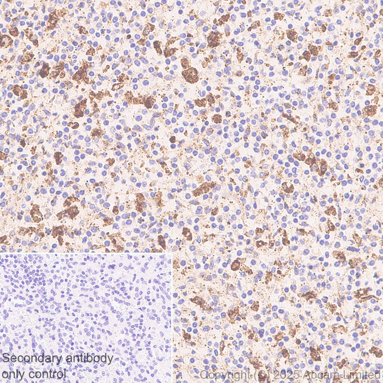 Immunohistochemistry (Formalin/PFA-fixed paraffin-embedded sections) - Anti-PSAP antibody [RM1353] (AB324885)