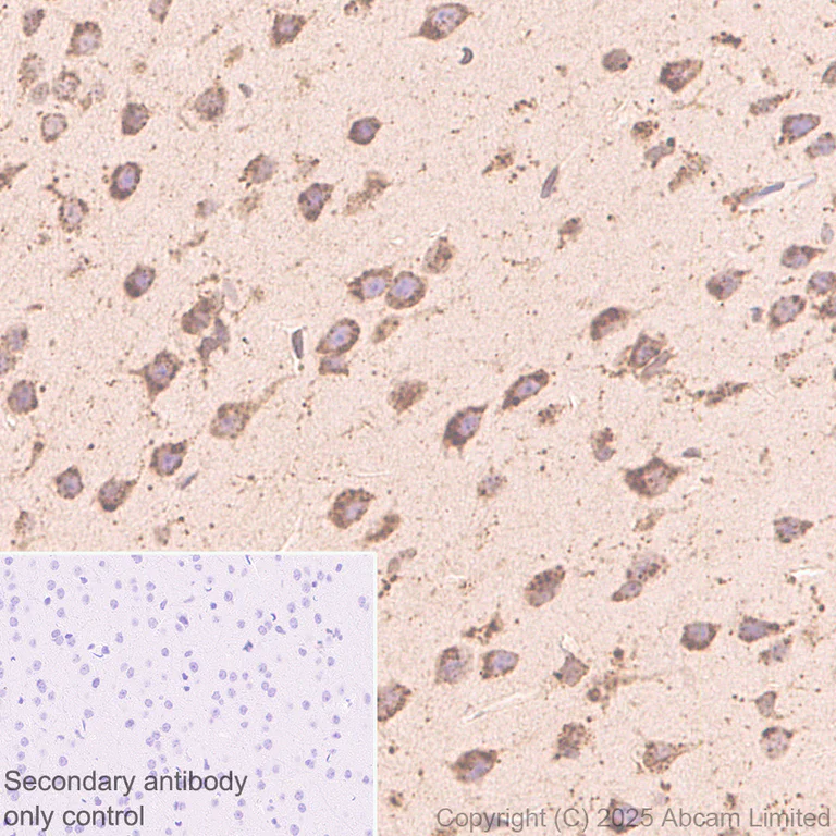 Immunohistochemistry (Formalin/PFA-fixed paraffin-embedded sections) - Anti-PSAP antibody [RM1353] (AB324885)