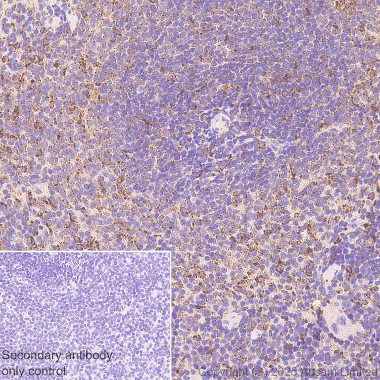 Immunohistochemistry (Formalin/PFA-fixed paraffin-embedded sections) - Anti-PSAP antibody [RM1353] (AB324885)