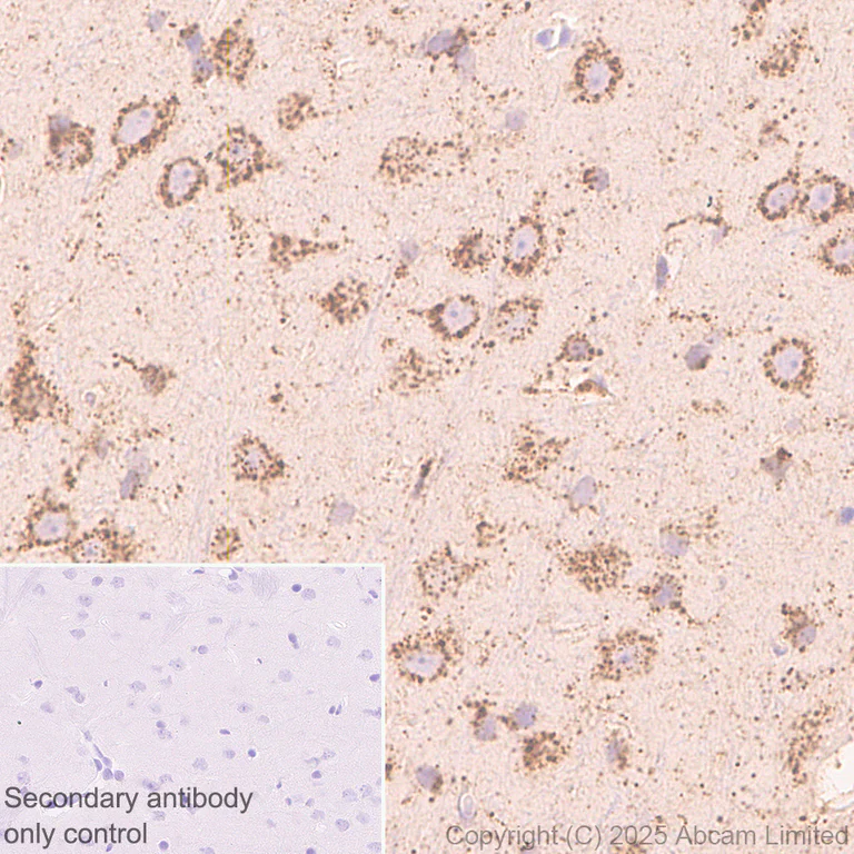 Immunohistochemistry (Formalin/PFA-fixed paraffin-embedded sections) - Anti-PSAP antibody [RM1353] (AB324885)