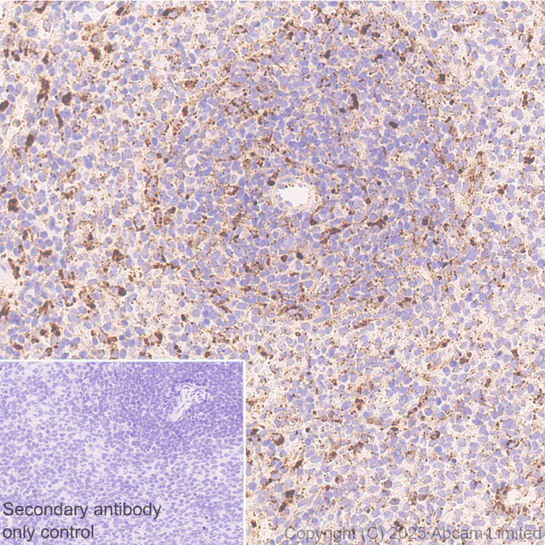Immunohistochemistry (Formalin/PFA-fixed paraffin-embedded sections) - Anti-PSAP antibody [RM1353] (AB324885)