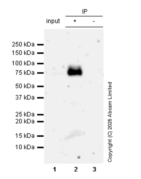 Immunoprecipitation - Anti-PSAP antibody [RM1353] (AB324885)
