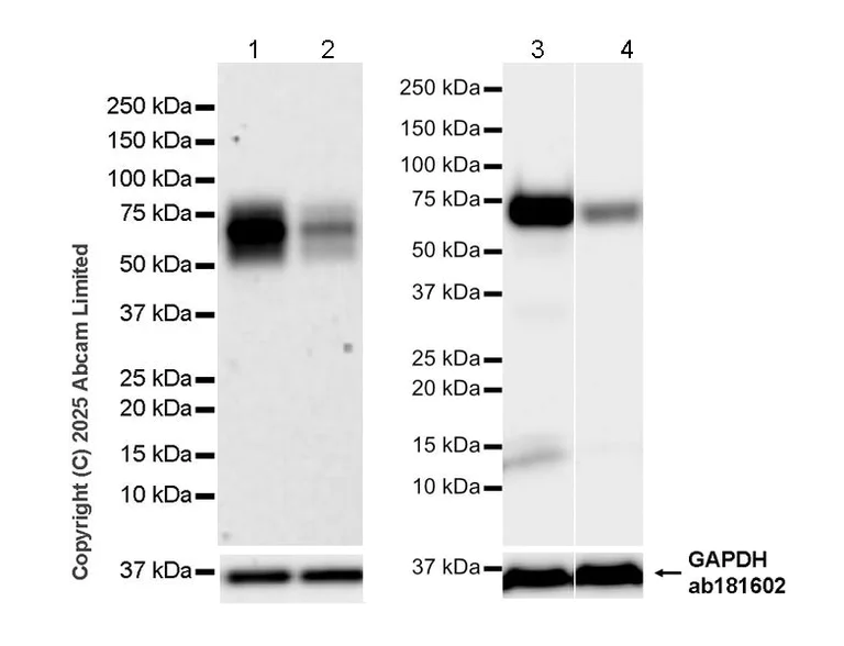 Western blot - Anti-PSAP antibody [RM1353] (AB324885)