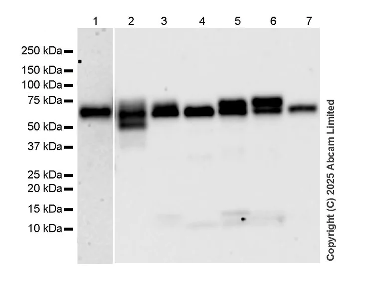 Western blot - Anti-PSAP antibody [RM1353] (AB324885)