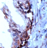 Immunohistochemistry (Formalin/PFA-fixed paraffin-embedded sections) - Anti-PSCA antibody (AB15168)