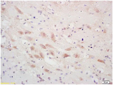 Immunohistochemistry (Formalin/PFA-fixed paraffin-embedded sections) - Anti-PSCA antibody (AB202966)