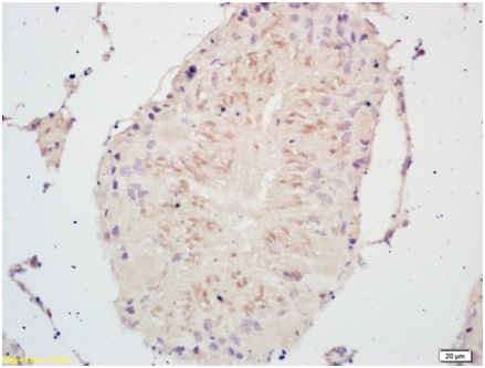 Immunohistochemistry (Formalin/PFA-fixed paraffin-embedded sections) - Anti-PSCA antibody (AB202966)