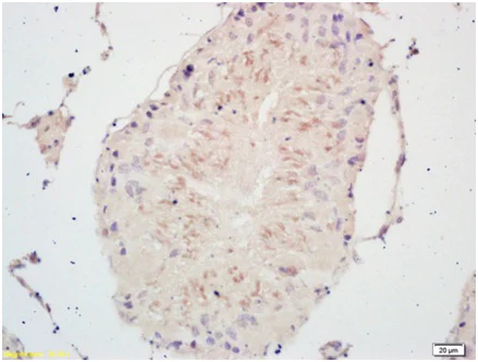 Immunohistochemistry (Formalin/PFA-fixed paraffin-embedded sections) - Anti-PSCA antibody (AB202966)
