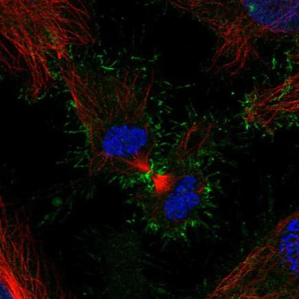 Immunocytochemistry/ Immunofluorescence - Anti-PSCA antibody (AB220101)