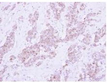 Immunohistochemistry (Formalin/PFA-fixed paraffin-embedded sections) - Anti-PSD4 antibody (AB154008)