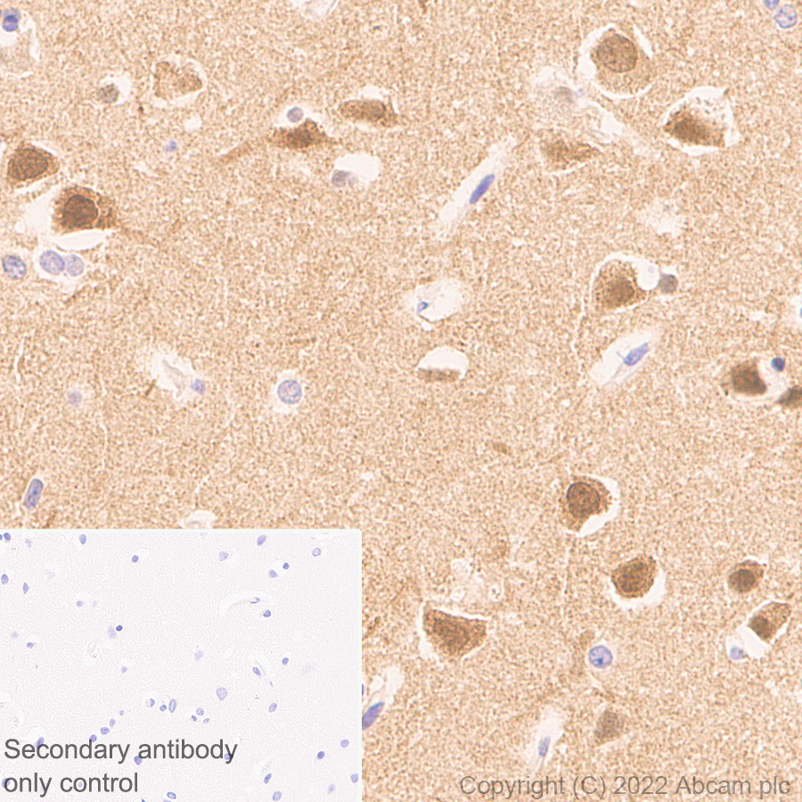 Immunohistochemistry (Formalin/PFA-fixed paraffin-embedded sections) - Anti-PSD93 antibody [EPR26468-112] - BSA and Azide free (AB289997), expandable thumbnail