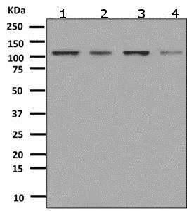 Western blot - Anti-PSD93 antibody [EPR8740] (AB151721), expandable thumbnail