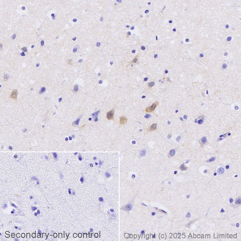 Immunohistochemistry (Formalin/PFA-fixed paraffin-embedded sections) - Anti-PSD95 antibody [7E3-1B8] - Synaptic Marker (AB13552)