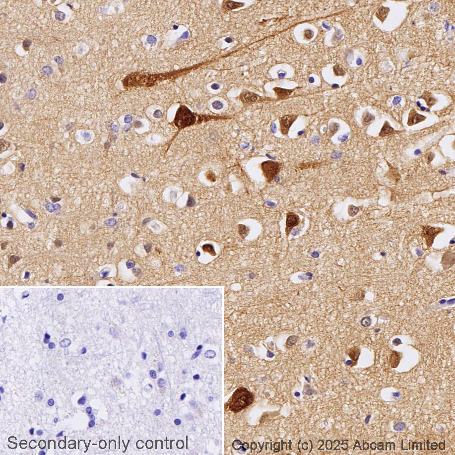 Anti-PSD95 antibody [EPR23124-118] - Synaptic Marker