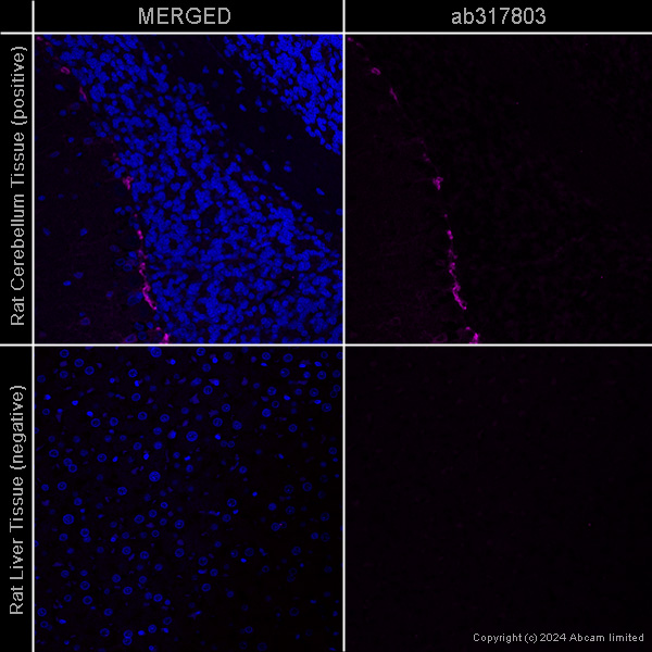 Immunohistochemistry (Formalin/PFA-fixed paraffin-embedded sections) - Anti-PSD95 antibody [EPR23124-118] - Synaptic Marker – Goat IgG (Chimeric) (AB317793), expandable thumbnail