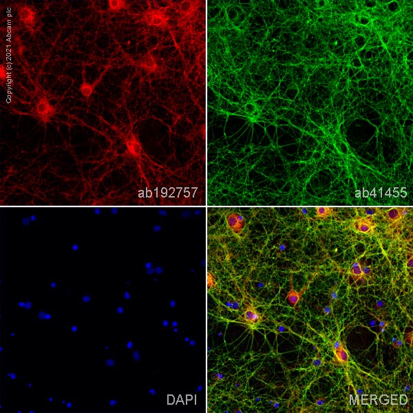 Immunocytochemistry - Anti-PSD95 antibody [K28/43] - Synaptic Marker (AB192757), expandable thumbnail