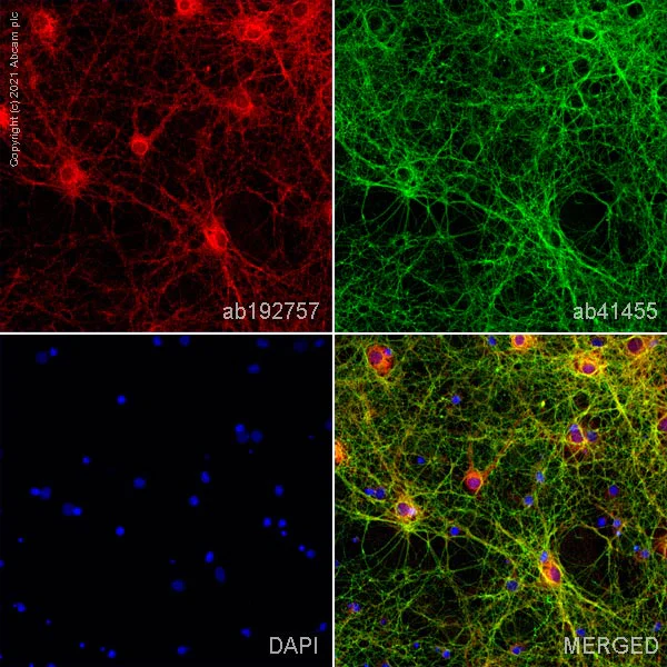 Immunocytochemistry - Anti-PSD95 antibody [K28/43] - Synaptic Marker (AB192757)