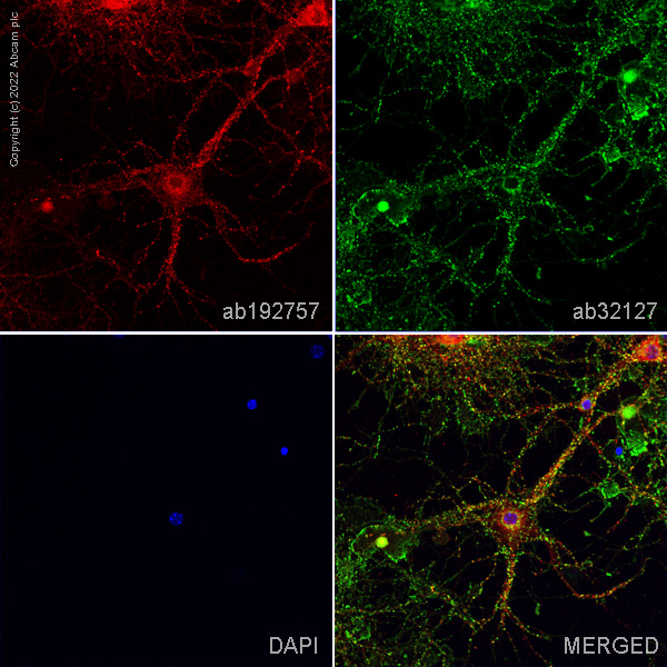 Immunocytochemistry - Anti-PSD95 antibody [K28/43] - Synaptic Marker (AB192757), expandable thumbnail