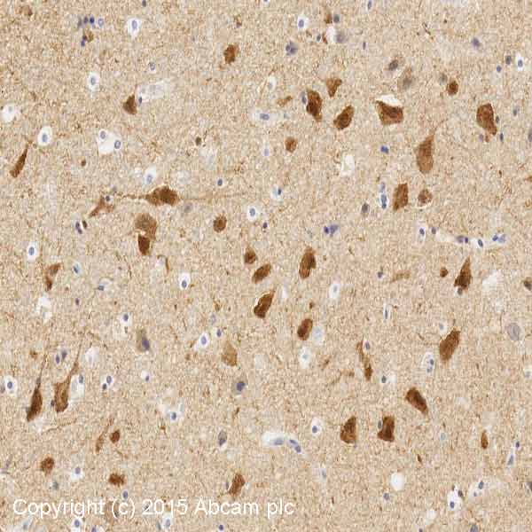 Immunohistochemistry (Formalin/PFA-fixed paraffin-embedded sections) - Anti-PSD95 antibody [K28/43] - Synaptic Marker (AB192757), expandable thumbnail