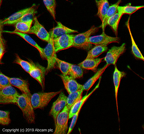 Immunocytochemistry/ Immunofluorescence - Anti-PSD95 antibody - Synaptic Marker (ab18258), expandable thumbnail