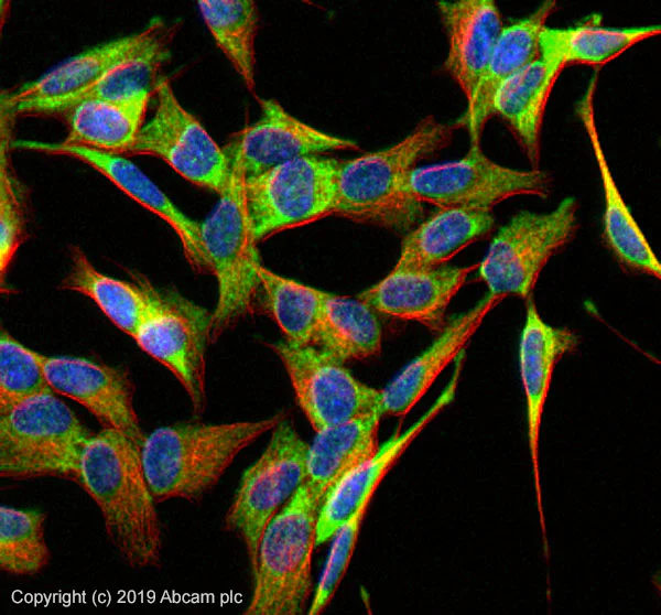 Immunocytochemistry/ Immunofluorescence - Anti-PSD95 antibody - Synaptic Marker (AB18258)
