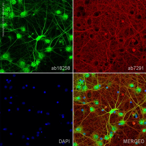 Immunocytochemistry/ Immunofluorescence - Anti-PSD95 antibody - Synaptic Marker (AB18258), expandable thumbnail
