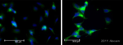 Immunocytochemistry/ Immunofluorescence - Anti-PSD95 antibody - Synaptic Marker (AB18258), expandable thumbnail