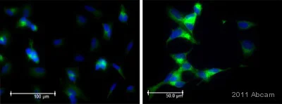 Immunocytochemistry/ Immunofluorescence - Anti-PSD95 antibody - Synaptic Marker (AB18258)