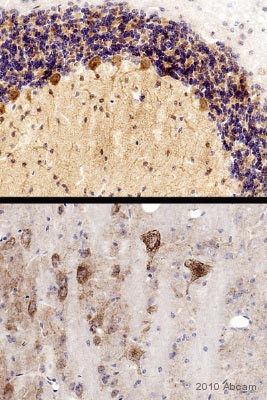 Immunohistochemistry (Formalin/PFA-fixed paraffin-embedded sections) - Anti-PSD95 antibody - Synaptic Marker (AB18258), expandable thumbnail