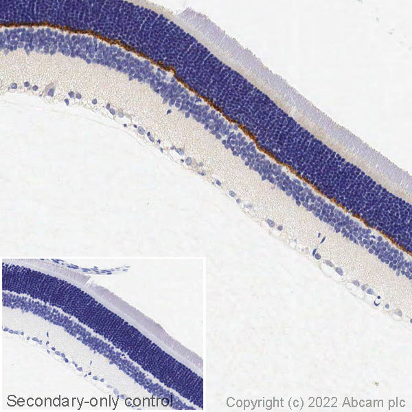 Immunohistochemistry (Formalin/PFA-fixed paraffin-embedded sections) - Anti-PSD95 antibody - Synaptic Marker (AB18258), expandable thumbnail