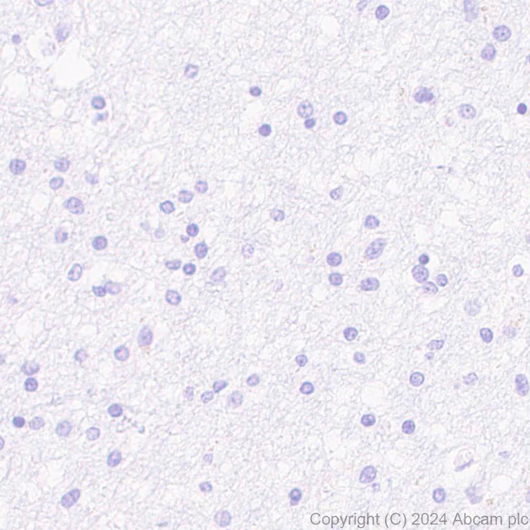 Immunohistochemistry (Formalin/PFA-fixed paraffin-embedded sections) - Anti-Pseudomonas Outer membrane porin F antibody [EPR28629-91] (AB316973)